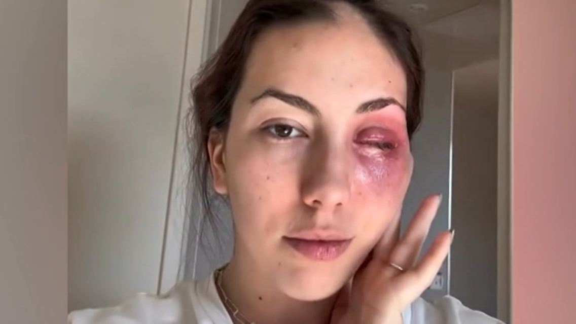 auge2.jpg
