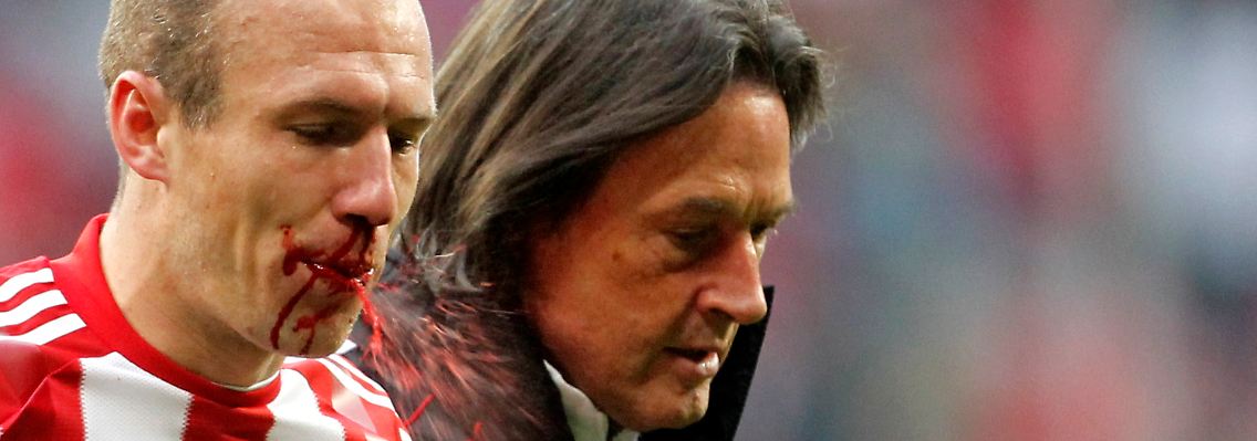Die Bayern wollen sich in Mainz keinesfalls eine blutige Nase holen.