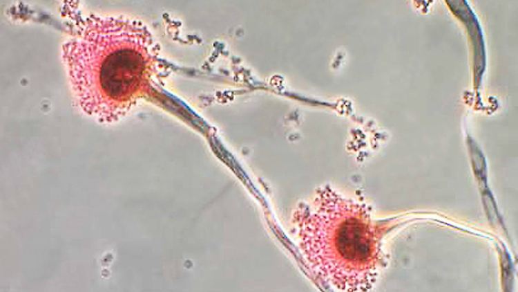 Aspergillus fumigatus gehört zu den verbreitetsten Spezies auf der Erde überhaupt, der Pilz findet sich von der Antarktis bis zur Sahara praktisch überall.