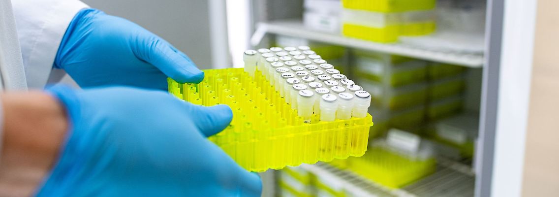Ehec-Fälle werden mit Proben im Labor bstätigt.