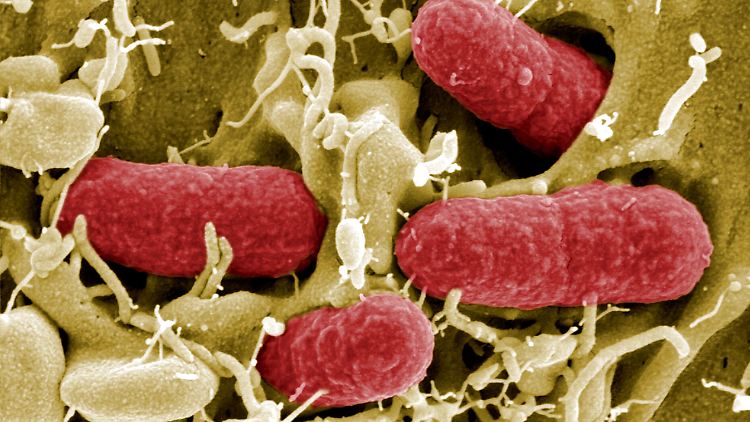 Die elektronenmikroskopische Aufnahme von Ehec-Bakterien. Sie sind eine gefährliche Variante des harmlosen Darmbewohners Escherichia coli.