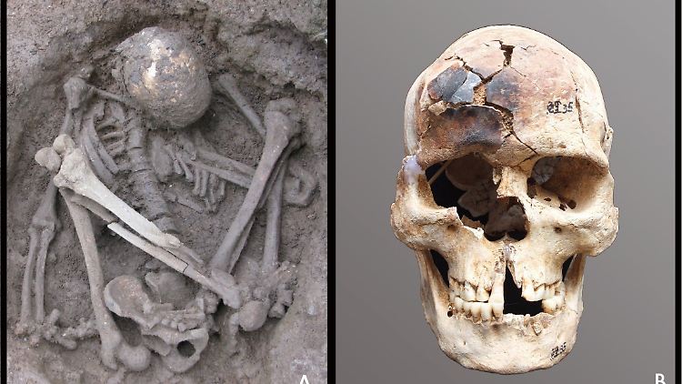 Auf ein Alter von etwa 7000 Jahren wird der Fund eines jungen Mannes (li.) geschätzt - sein Schädel (re.) weist Brandspuren auf.