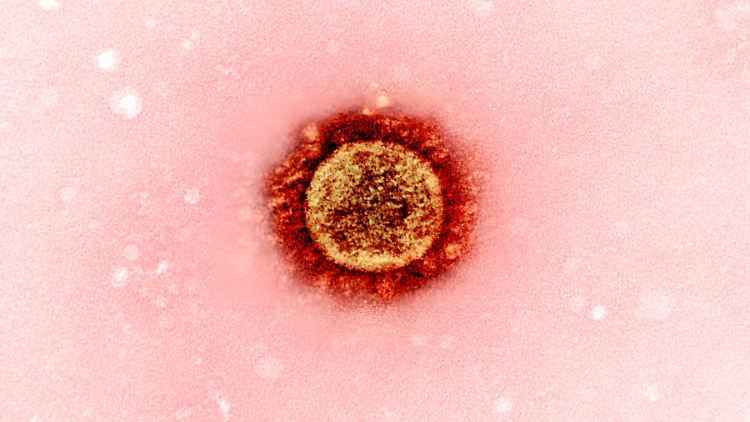 Ein SARS-CoV-2-Viruspartikel unter dem Elektronenmikroskop.
