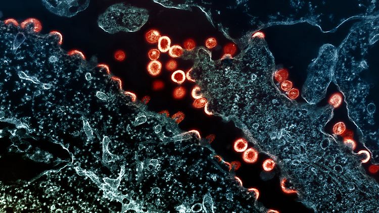 HIV-1-Viren (rot/gelb) beim Austritt aus infizierten Zellen unterm Elektronenmikroskop. 