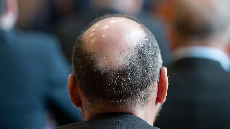 Bis zu 80 Prozent der Männer in Deutschland sind im Laufe ihres Lebens von Haarausfall betroffen. Bei Frauen ist es etwa jede Dritte.