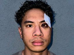 "Das war purer Rassismus": Comedian Tutty Tran geschlagen und beleidigt