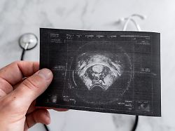 Gefährliche Strahlung: Medizinischer Dienst warnt vor illegalen Baby-Ultraschalls