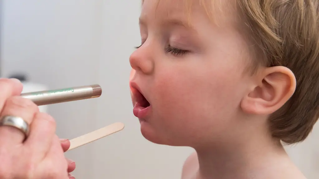 Immer-mehr-Kinder-erkranken-an-Scharlach-Bei-den-typischen-Symptomen-sollte-man-direkt-den-Arzt-aufsuchen