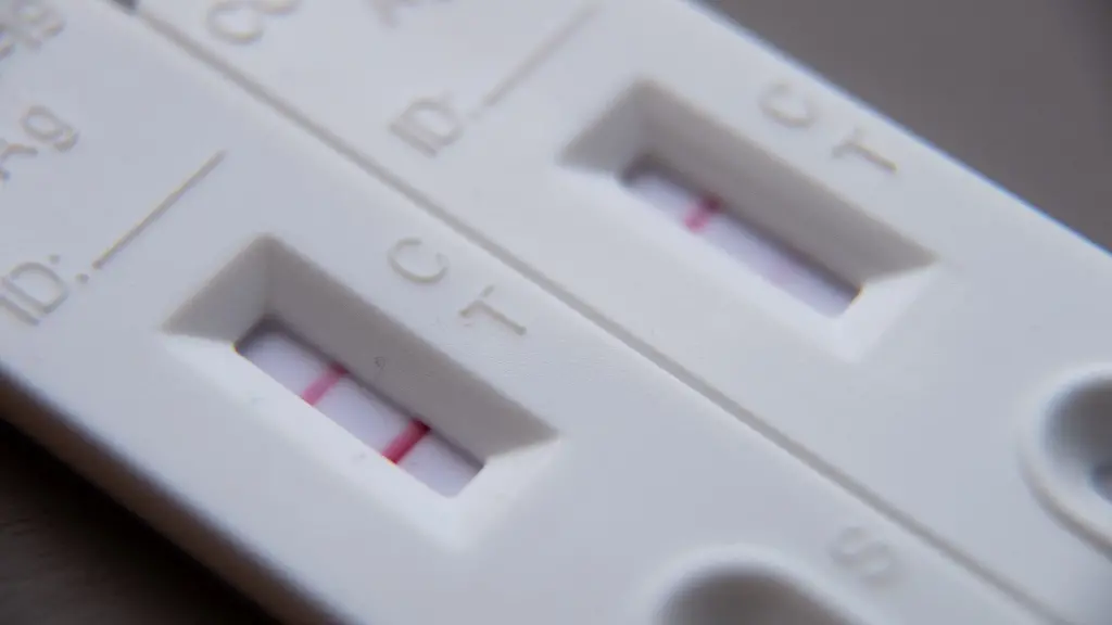 Wer-einen-positiven-Corona-Test-hat-aber-keine-Symptome-muss-in-der-Regel-auch-zur-Arbeit-gehen