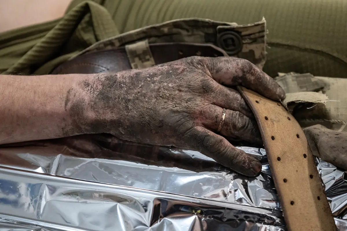 2023-02-21T080106Z-574393678-RC2CEZ9IESN3-RTRMADP-3-UKRAINE-CRISIS-FRONTLINE-MEDICS