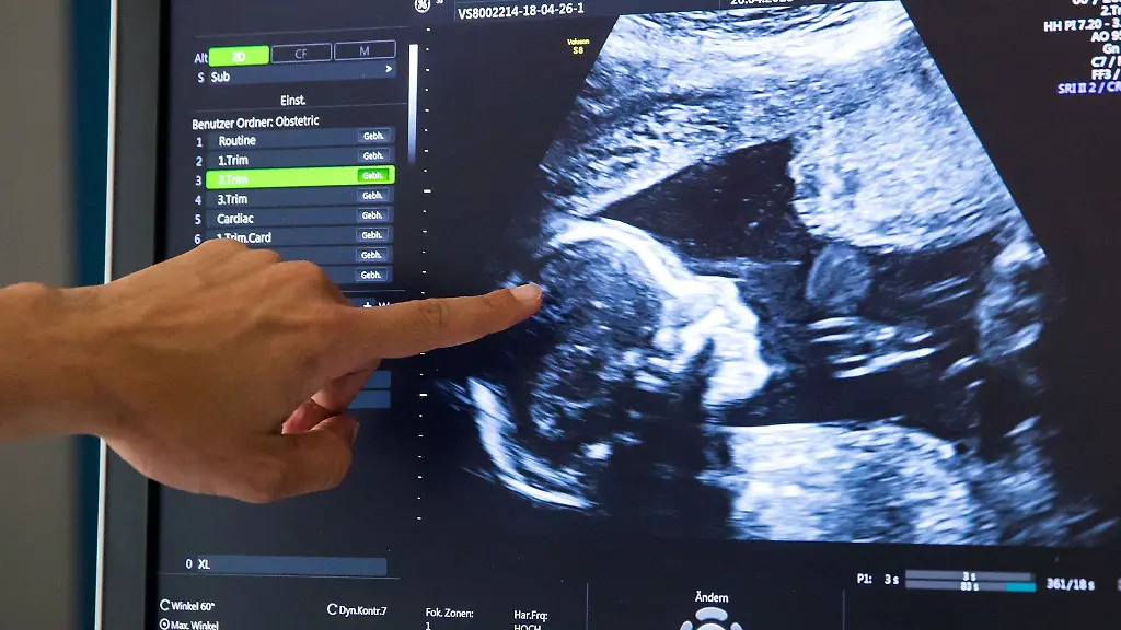 Waehrend-einer-praenatalen-Ultraschall-Untersuchung-einer-in-der-18-Woche-schwangeren-Frau-deutet-ein-Arzt-auf-den-Kopf-des-Kindes