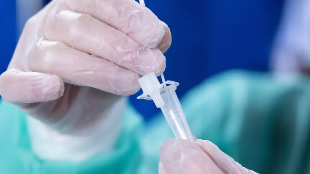 Ohne-Genom-Sequenzen-ist-es-schwierig-die-Risiken-von-XBB-1-5-richtig-einzuschaetzen