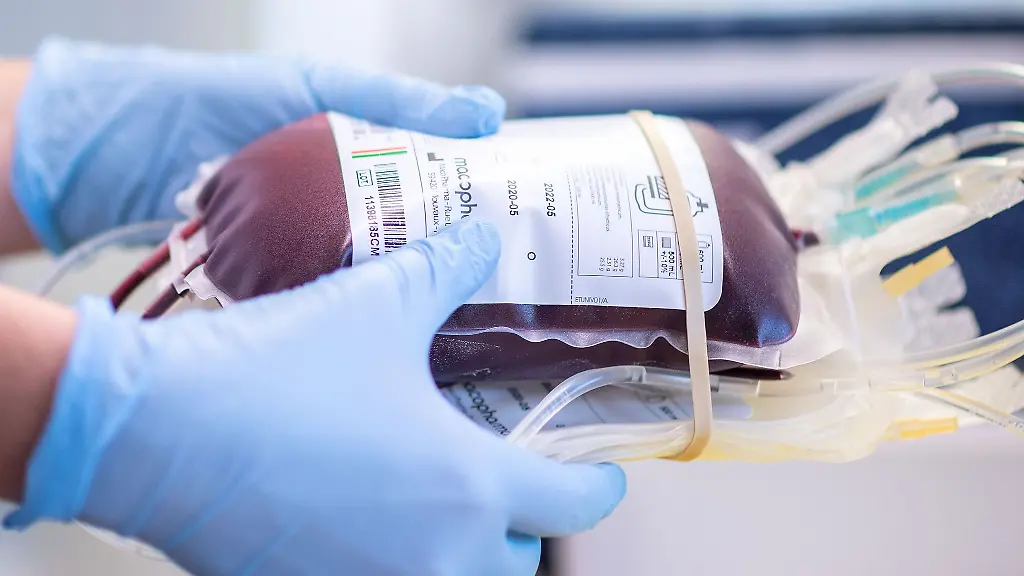 Eine-Mitarbeiterin-eines-Blutspendezentrums-haelt-eine-Blutkonserve-in-den-Haenden