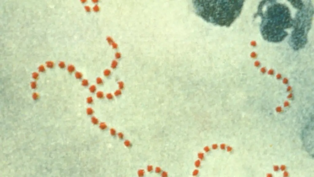 Streptococcus-pyogenes