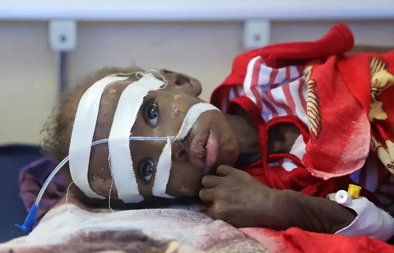 2022-10-13T141554Z-1553403132-RC2MNW9QKFP5-RTRMADP-3-SOMALIA-DROUGHT