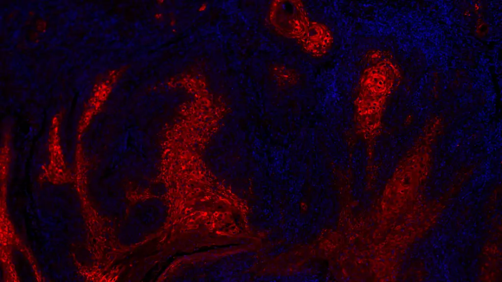 ACHTUNG-Frei-nur-im-Zusammenhang-mit-der-Berichterstattung-ueber-die-Studie