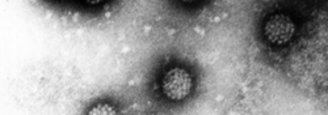 Elektronenmikroskopische Aufnahme mehrerer Humaner Papillomviren