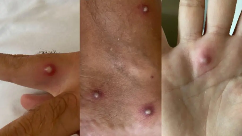 Nur-zur-redaktionellen-Verwendung-im-Zusammenhang-mit-der-aktuellen-Berichterstattung