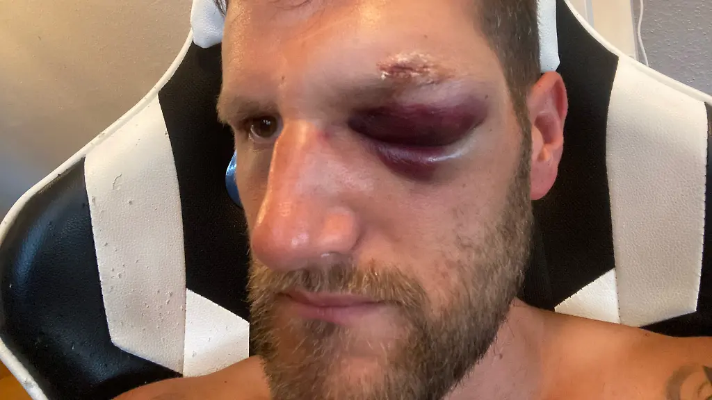 Schiedsrichter-Geoffrey-May-nach-dem-Angriff