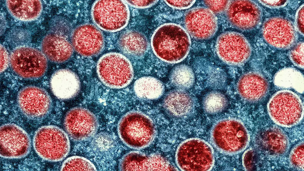 68660cabe3da1f2def12eb8b456d9839