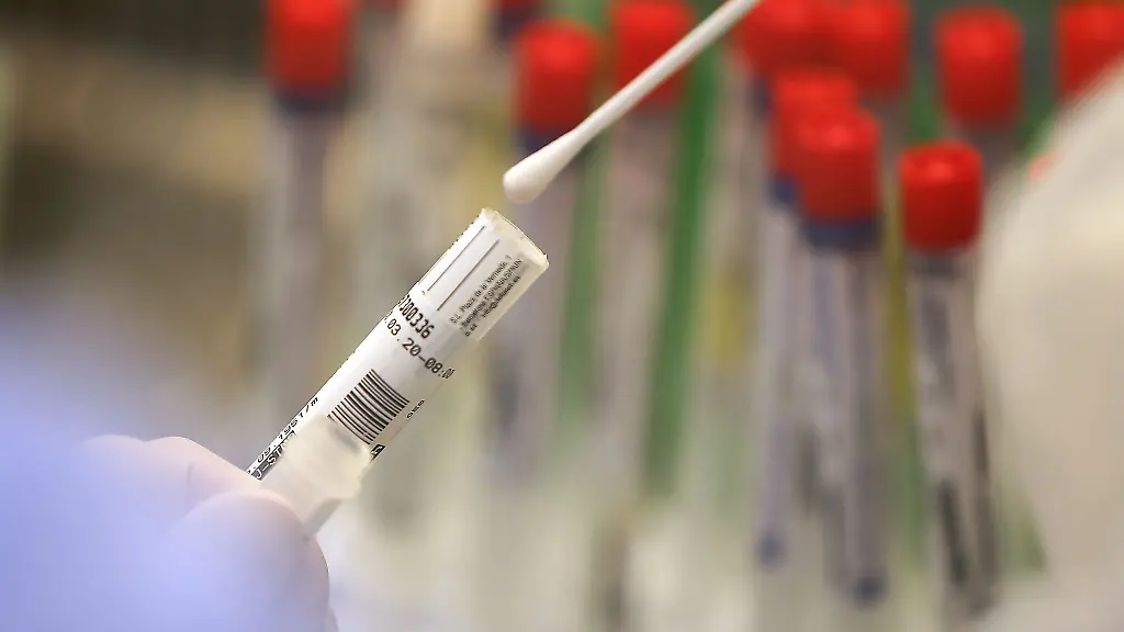 Eine-Laborantin-haelt-ein-Abstrichstaebchen-fuer-einen-Corona-Test-in-der-Hand