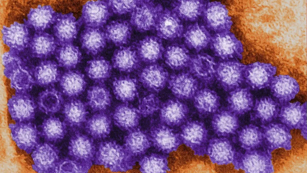 Norovirus