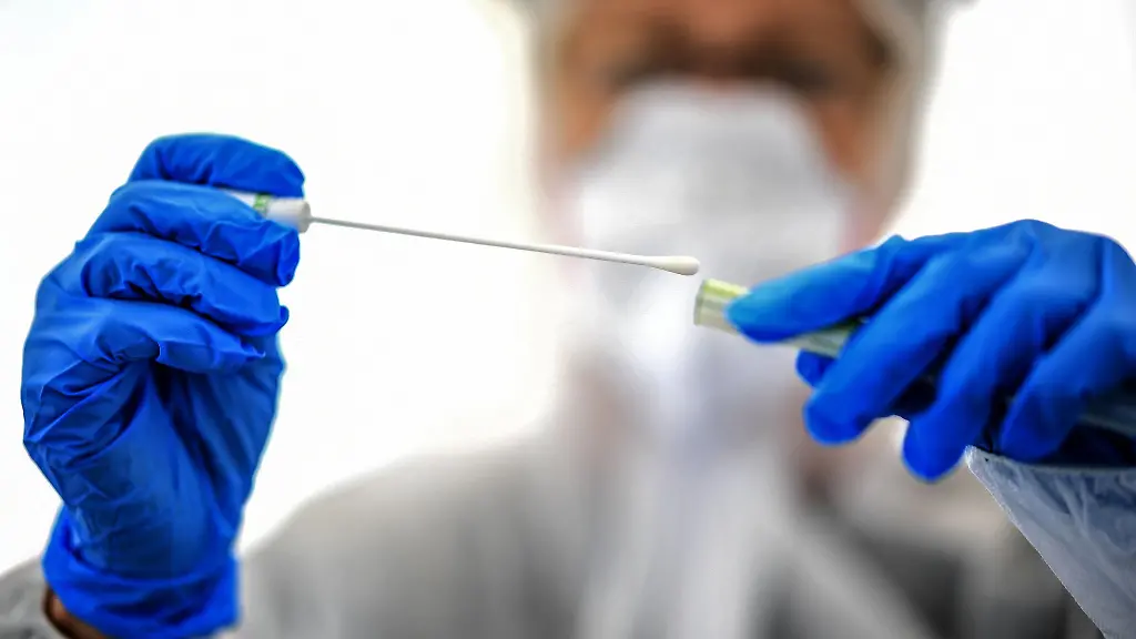 Ein-Abstrichstaebchen-wird-in-einer-ambulanten-Corona-Test-Einrichtung-fuer-die-Analyse-vorbereitet