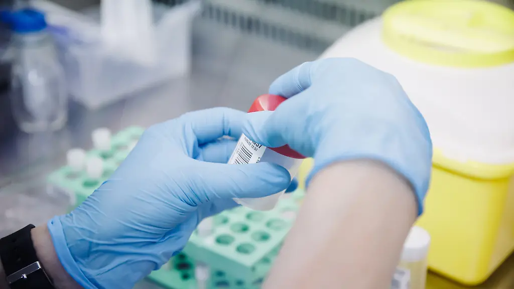 Der-erste-Mensch-bei-dem-in-Deutschland-Affenpocken-nachgewiesen-worden-waren-ist-mittlerweile-genesen