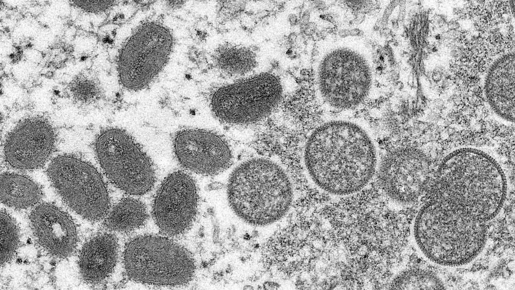 Das-Affenpocken-Virus-verursacht-meist-nur-milde-Symptome