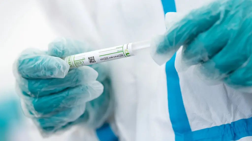 Ein-Mitarbeiter-haelt-ein-Corona-Testroehrchen-in-den-Haenden