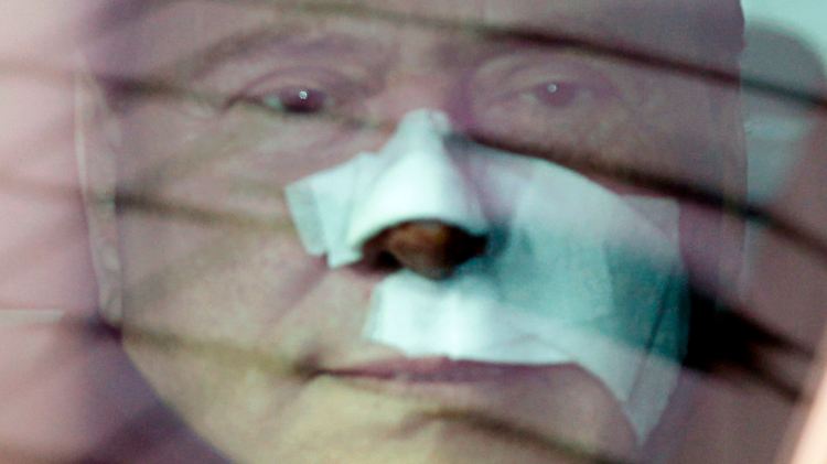 Berlusconi nach dem Eingriff.