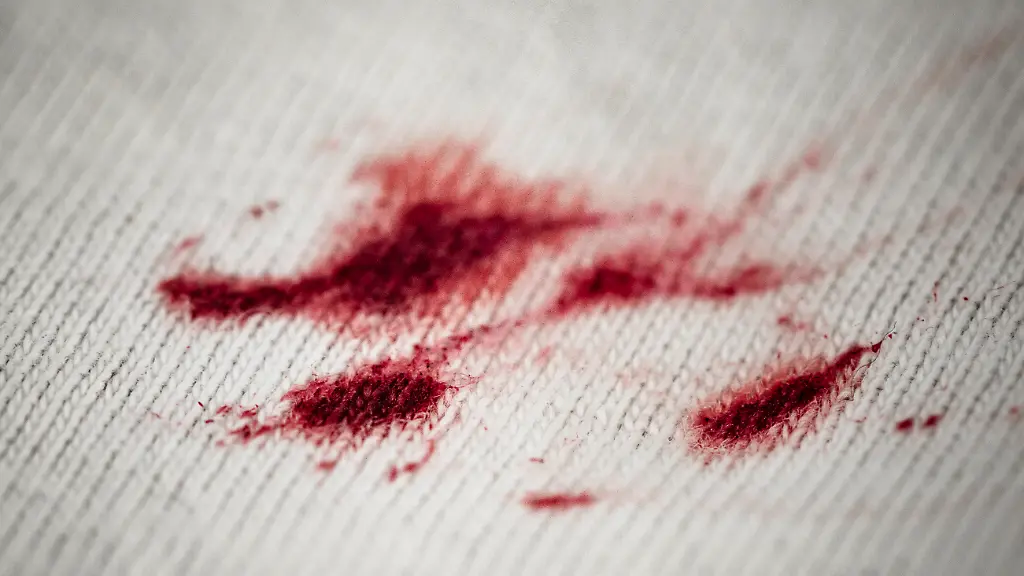 ACHTUNG-Frei-nur-im-Zusammenhang-mit-der-Berichterstattung-ueber-die-Studie