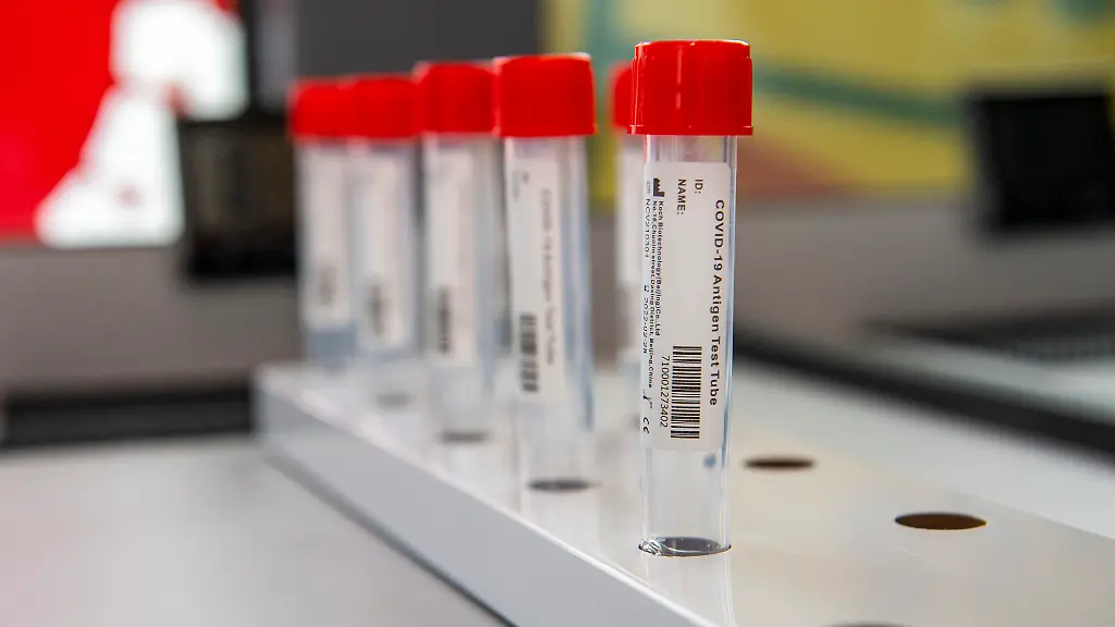 Die-Dunkelziffer-ist-mit-Sicherheit-hoeher-als-das-beobachtete-Infektionsgeschehen-sagte-der-erste-Vorsitzende-des-Verbandes-akkreditierter-Labore-Dr-Michael-Mueller