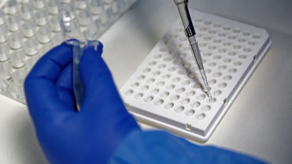 Eine-Mitarbeiterin-eines-Labors-fuellt-mit-einer-Pipette-eine-Testfluessigkeit-in-einer-Traegerplatte