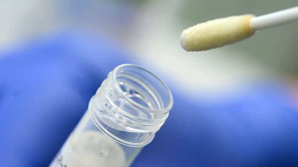 Ein-Abstrich-fuer-das-Testverfahren-auf-das-Coronavirus