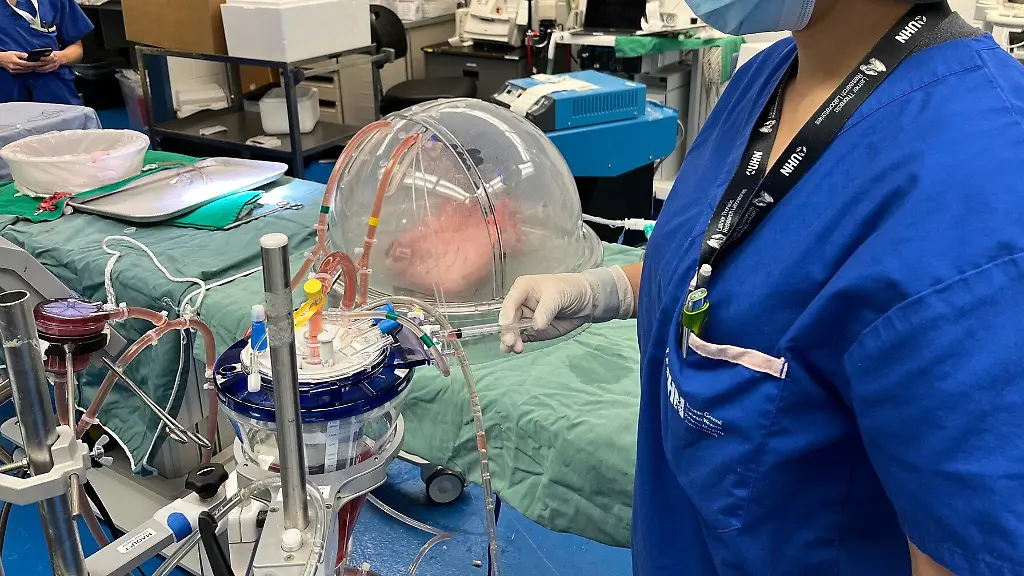 ex-vivo-lung-perfusion