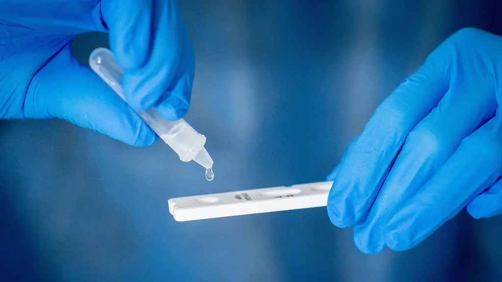 Medizinisch-geschultes-Personal-fuehrt-einen-Corona-Schnelltest-durch