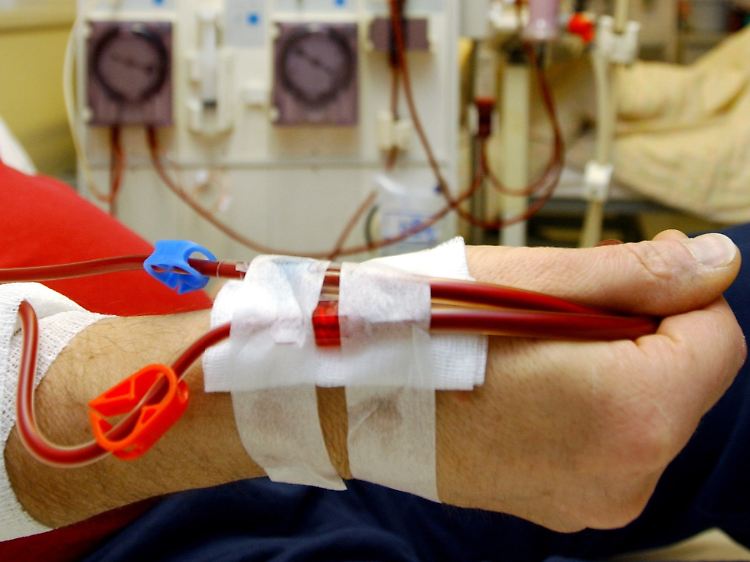 Das Verfahren zur Blutreinigung bei einer Blutvergiftung ist mit der Dialyse, die bei Nierenversagen zum Einsatz kommt, vergleichbar.