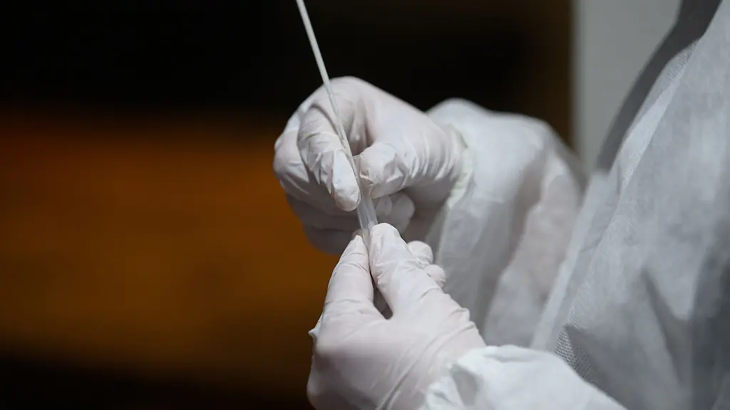 Ein-Corona-Schnelltest-wird-in-einer-Teststation-aufbereitet