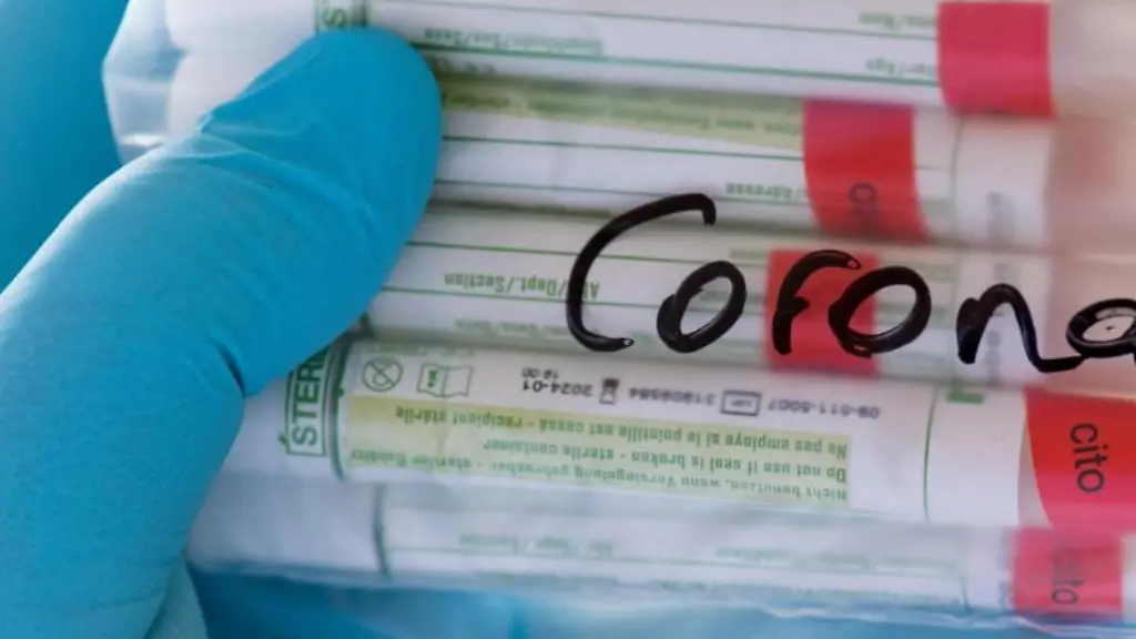 Proben-fuer-Corona-Tests-werden-im-Diagnosticum-Labor-in-Plauen-fuer-die-weitere-Untersuchung-vorbereitet