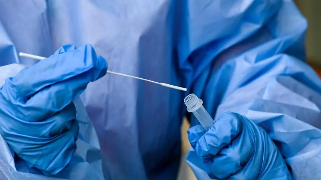 Eine-Krankenschwester-steckt-ein-Abstrichstaebchen-in-die-Fluessigkeit-eines-Corona-Schnelltests