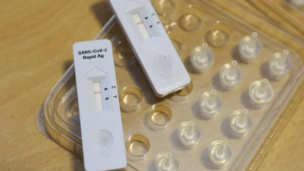 Corona-Schnelltests-liegen-in-einem-Testzentrum-auf-einem-Tisch