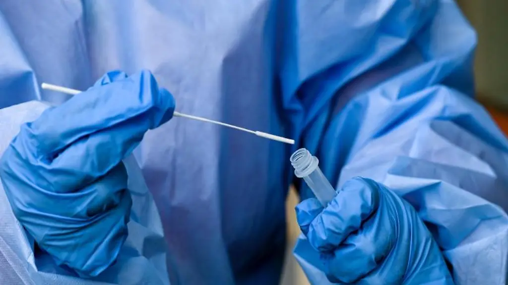 Eine-Krankenschwester-steckt-ein-Abstrichstaebchen-in-die-Fluessigkeit-eines-Corona-Schnelltests