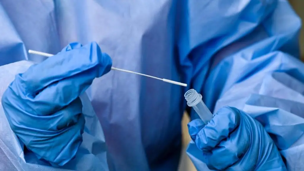 Eine-Krankenschwester-steckt-waehrend-einer-Corona-Testung-ein-Teststaebchen-in-die-Fluessigkeit-eines-Schnelltests