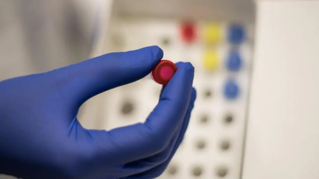 Eine-technische-Assistentin-haelt-in-einem-Labor-des-Instituts-fuer-Molekulare-Biologie-in-Mainz-eine-Probe-in-der-Hand