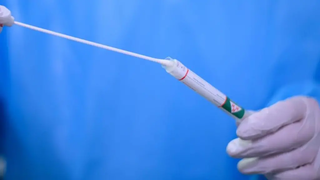 Ein-Arzt-haelt-einen-Coronavirus-Test-in-den-Haenden