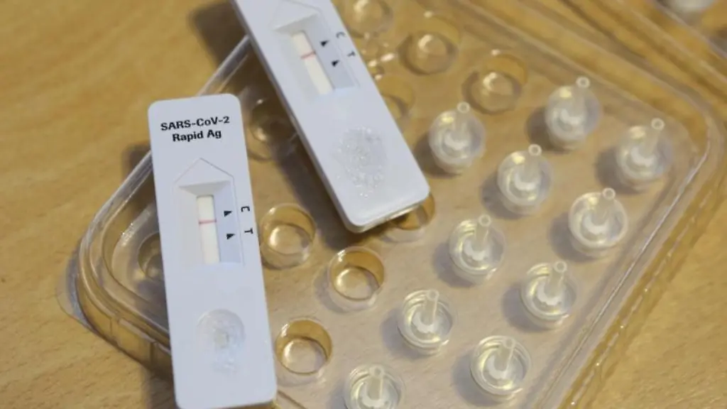 Corona-Schnelltests-liegen-in-einem-Testzentrum-auf-einem-Tisch