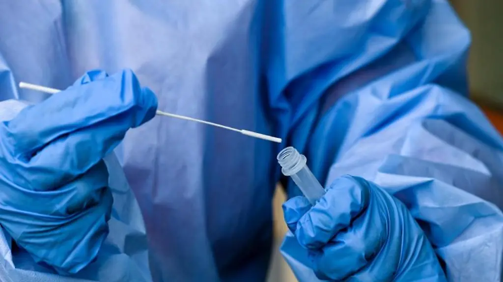 Eine-Krankenschwester-steckt-ein-Abstrichstaebchen-in-die-Fluessigkeit-eines-Corona-Schnelltests