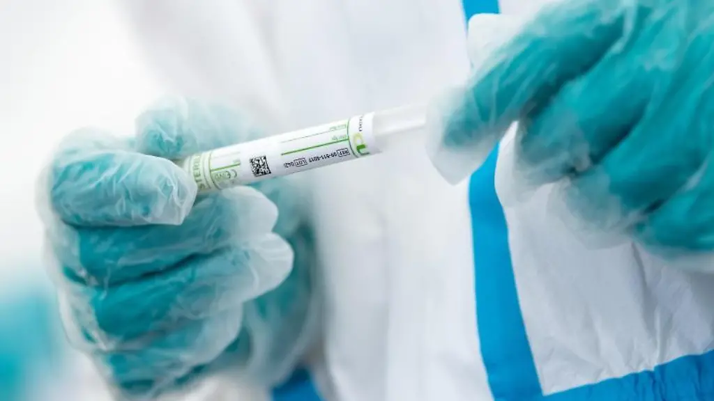 Ein-Mitarbeiter-haelt-ein-Corona-Testroehrchen-in-den-Haenden