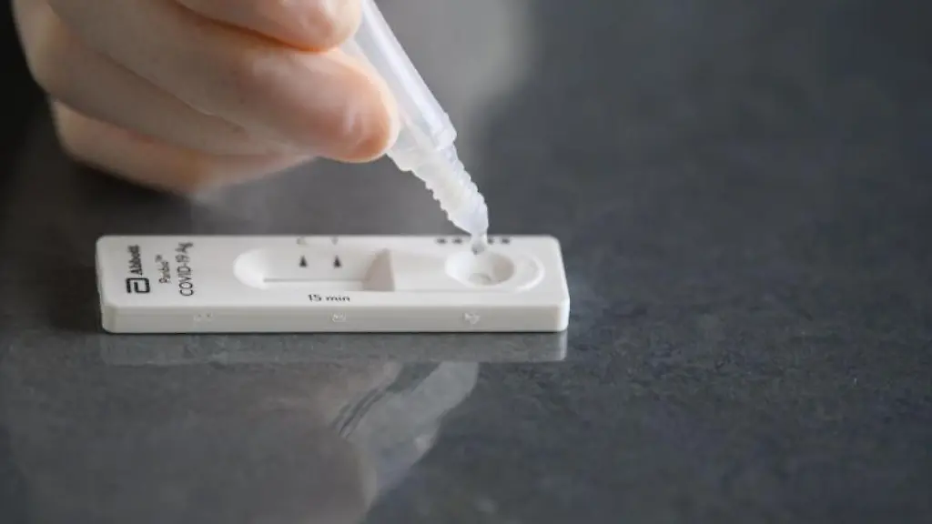 Eine-Loesung-wird-auf-eine-Testkassette-eines-Corona-Schnelltests-aufgetraeufelt